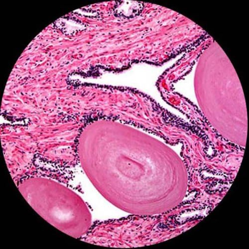 Digital Trinocular Compound Microscope, 40X-2500X Magnification, Infinity Objectives, 1.3MP Camera S737